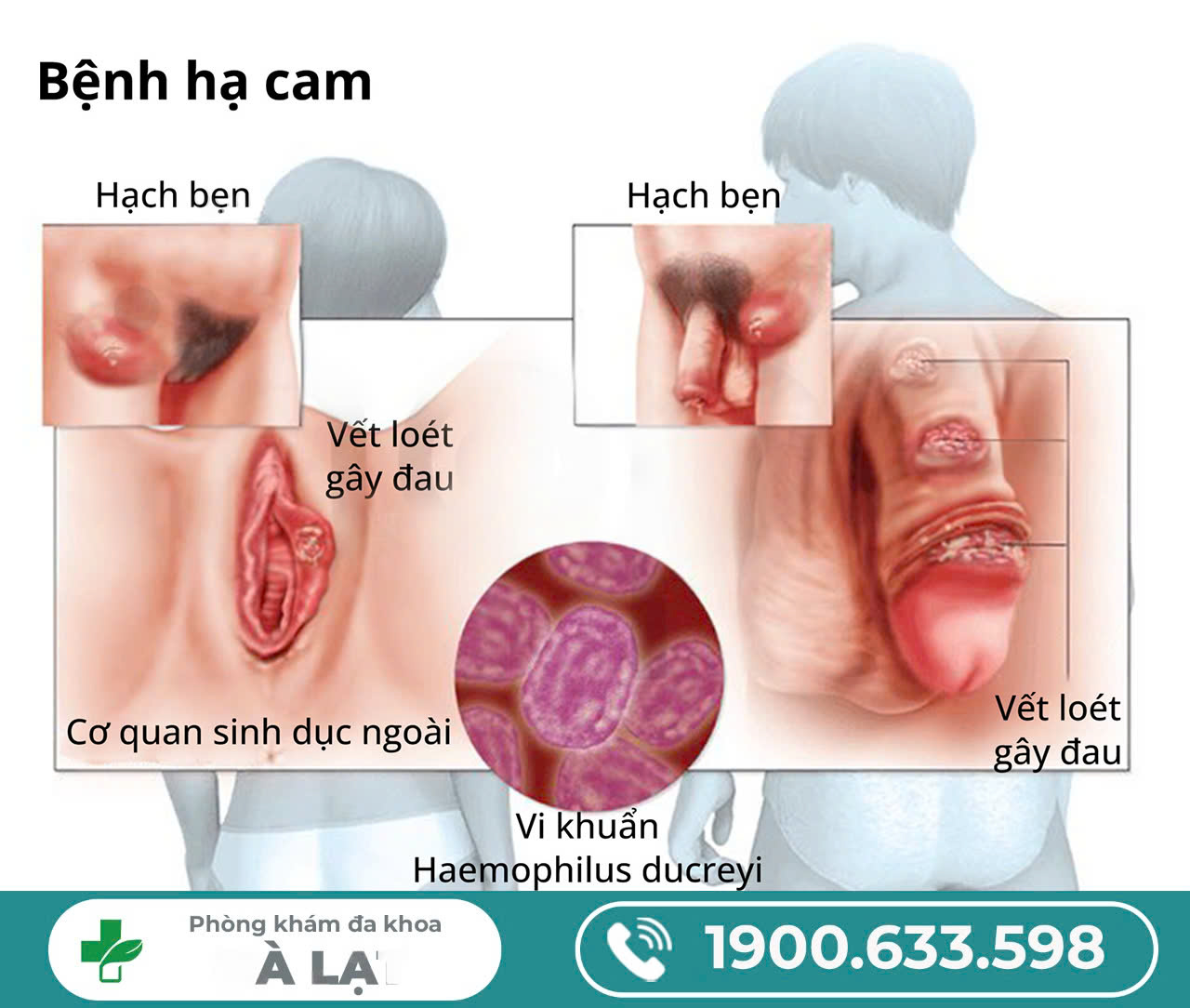 Hình ảnh minh họa